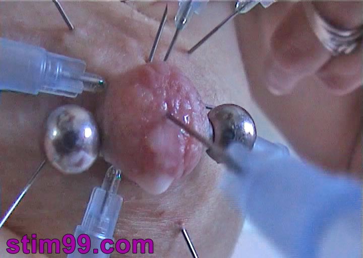 Saline Injection In Pussy Breast Nipples Extreme Fisting Videos
