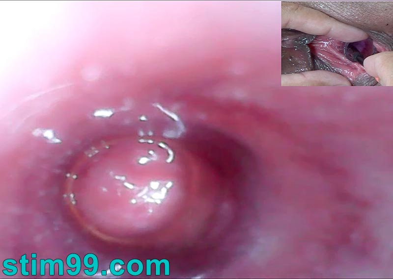 Trying watch peehole with endoscope camera