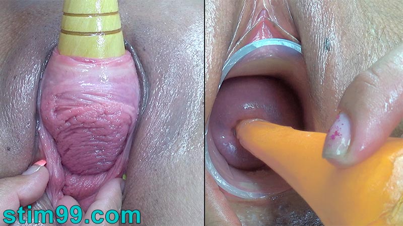 Wwwstim99 Com - Extreme Cervix Fucking Videos, Peehole Penetration. Needles Torture